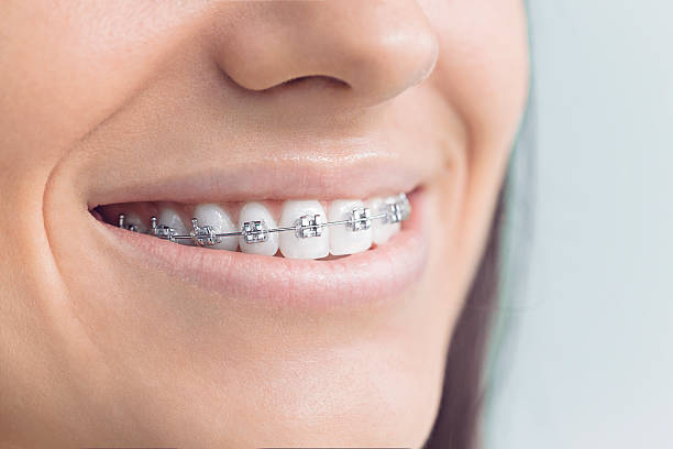 Best Veneers and Lumineers  in Ash Flat, AR